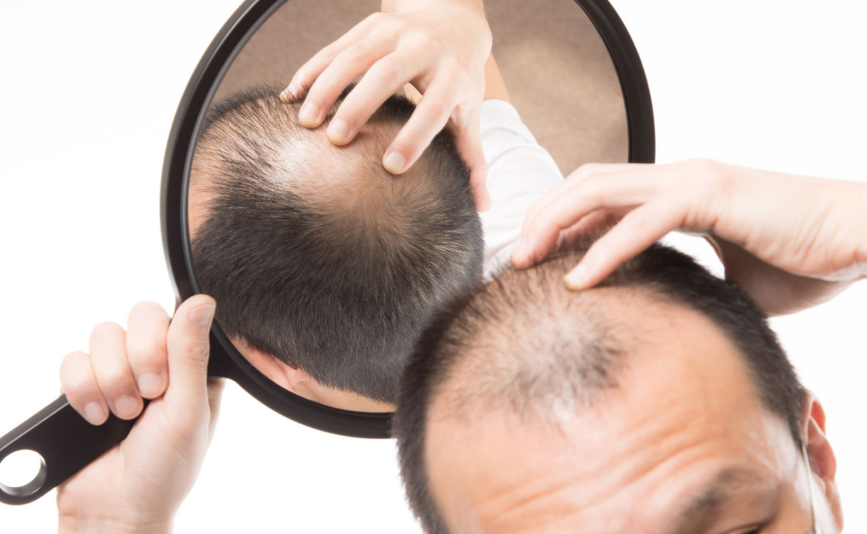 frijoles desarrollo de bueno Dermatología. Mitos y verdades sobre el #cabello por fin explicados | HC  Marbella International Hospital