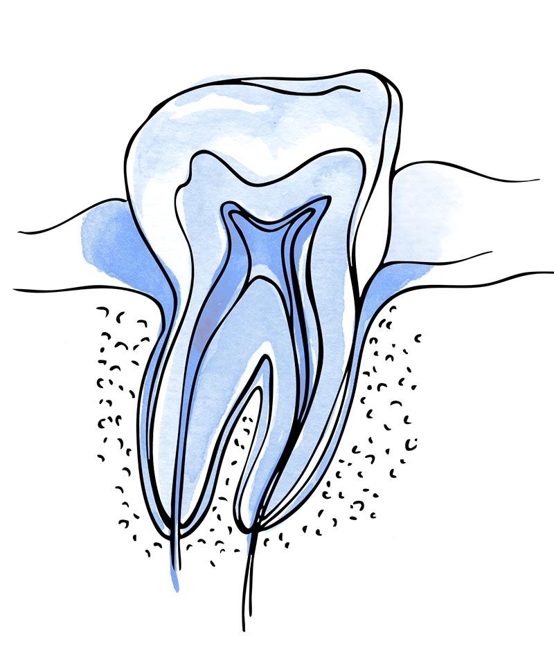 endodoncia