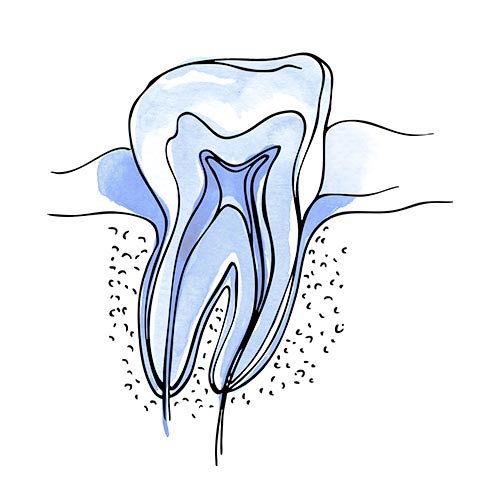 periodoncia Marbella