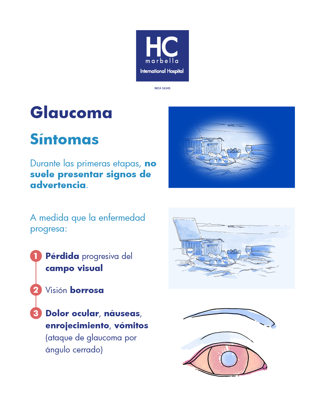 síntomas glaucoma