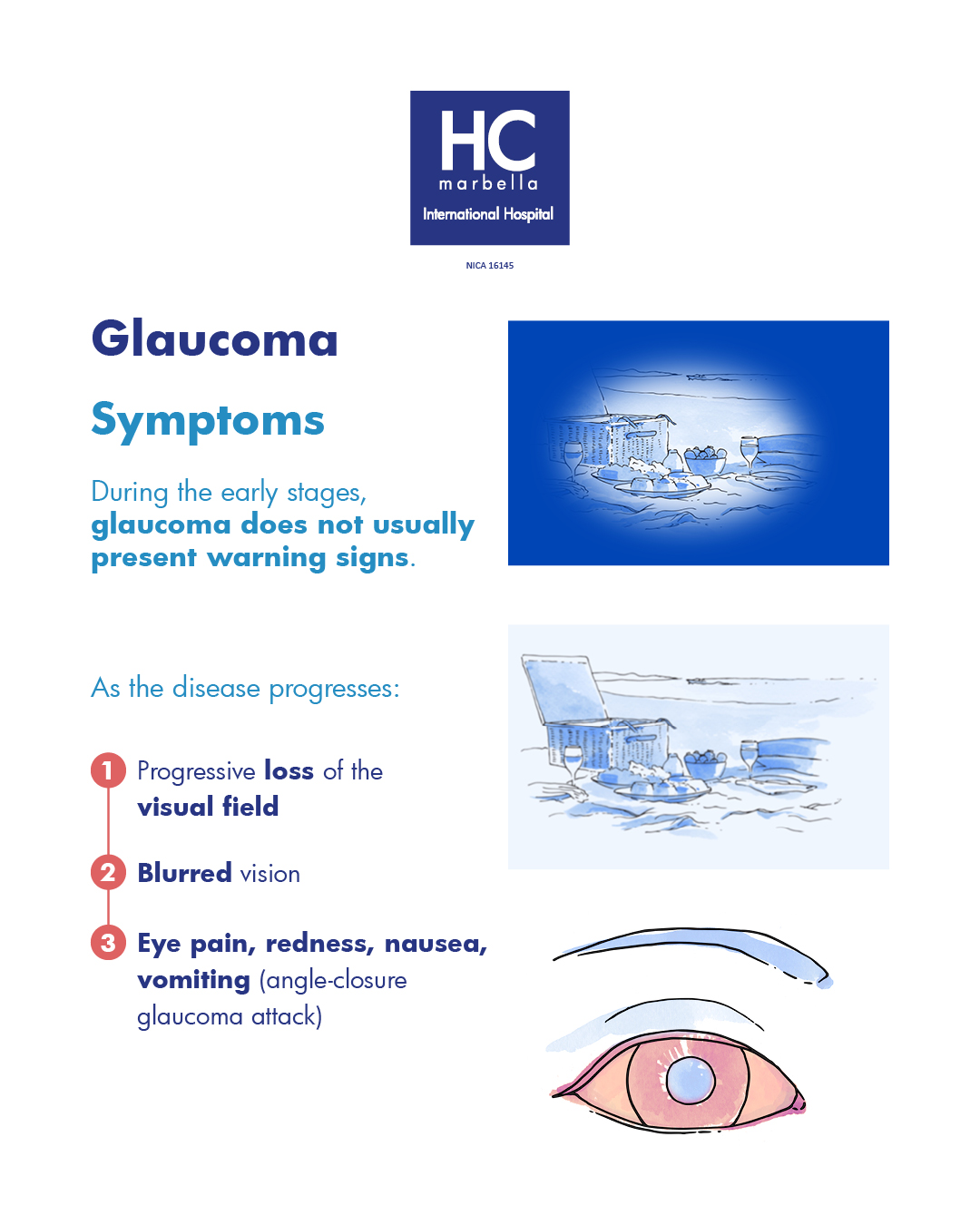 glaucoma symptoms 